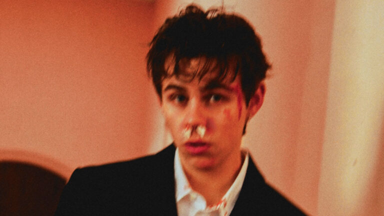 The Kid Laroi shares ‘A Cold Play’ video
